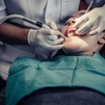 unravelling the mystery of root canal therapy benefits